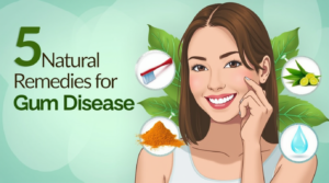 Natural Remedies for Gum Disease