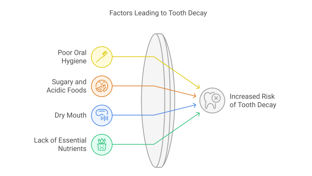 What Is Tooth Decay, and How Does It Happen