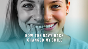 How the Navy Tooth Repair Hack Changed My Life