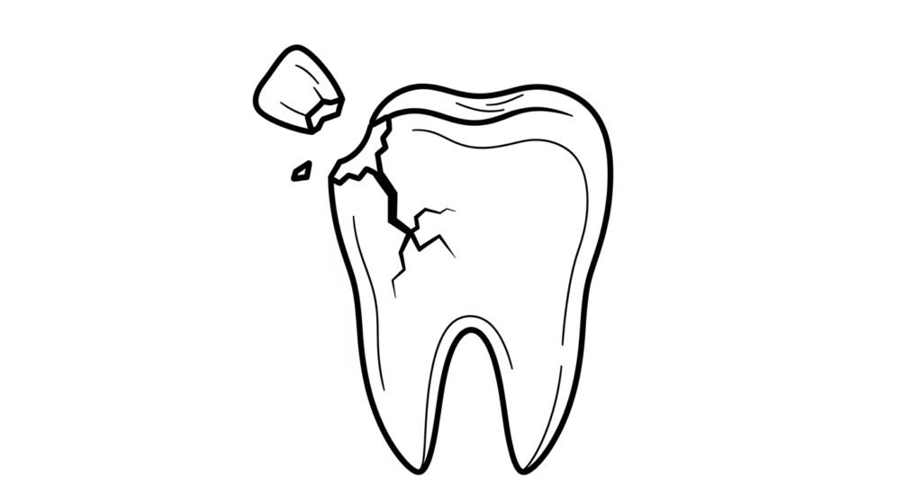 4 Dental Problems That Suddenly Accelerate After Age 50 3 A diagram illustrating a brittle tooth with a large chip broken off from the corner, representing age-related dental fragility.